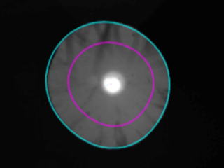 視力検査【視力1.0の見え方の質が見える】角膜形状/屈折力解析装置　OPD-Scan lll VS